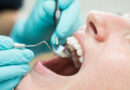 Adiós a los implantes dentales: crean fármaco sustentado en un monoclonal para crecer los dientes