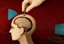 China acelera su apuesta neurotecnológica con un implante cerebral de colocación ultrarrápida