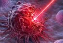 Una “espada láser” promete alivio, pero el glioblastoma sigue sin rendirse