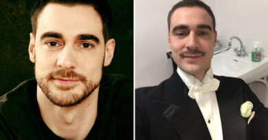 Dolores persistentes por prótesis antihernia llevan al actor Arnaud Denis a solicitar eutanasia en Bélgica