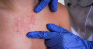 Sarampión se dispara en EU: Nueva York activa emergencia y Pennsylvania rebasa los mil contagios